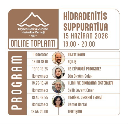 Online Toplantı